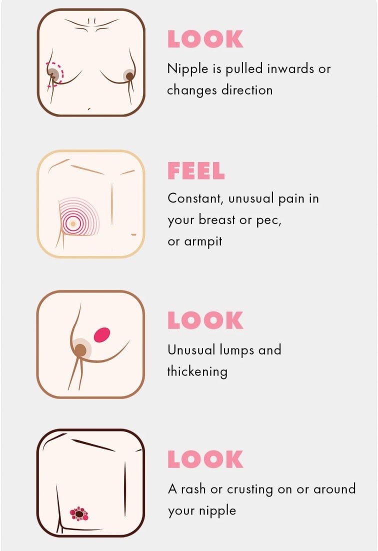 CoppaFeel! Signs and Symptoms